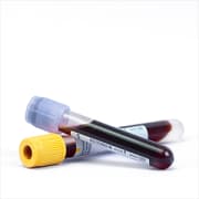 At-home Blood Testing