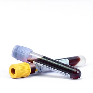 الفحوصات المنزلية