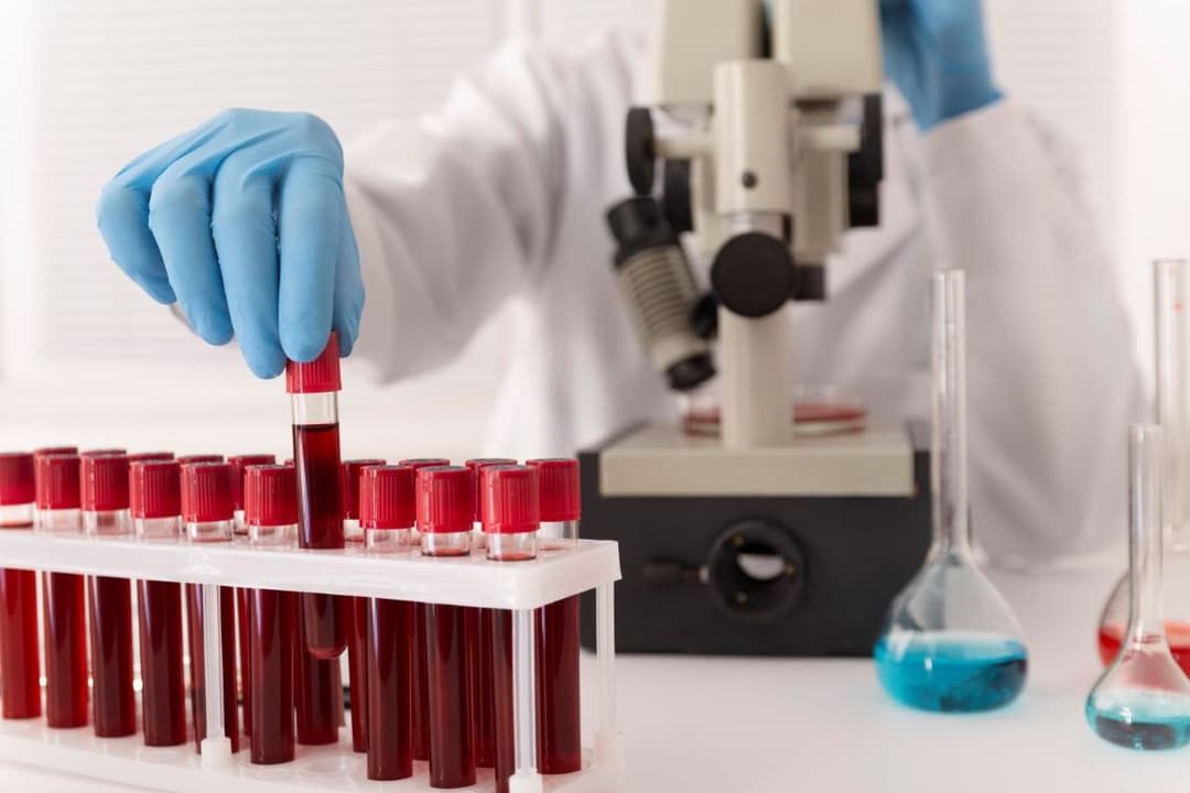 Same Day STD Testing at Home in Dubai