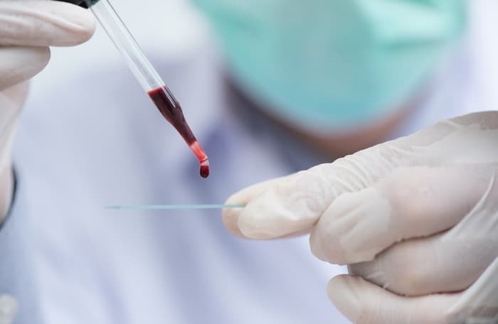 Can a CBC Test Detect Vitamin Deficiencies Common in Dubai Residents?