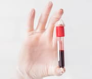 فحوصات ال-دي أن إي