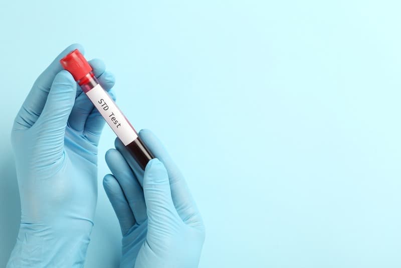8 Powerful Benefits of Choosing an STD Test at home in Dubai