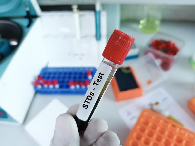 Your Guide to Private STD Testing at Home in Dubai