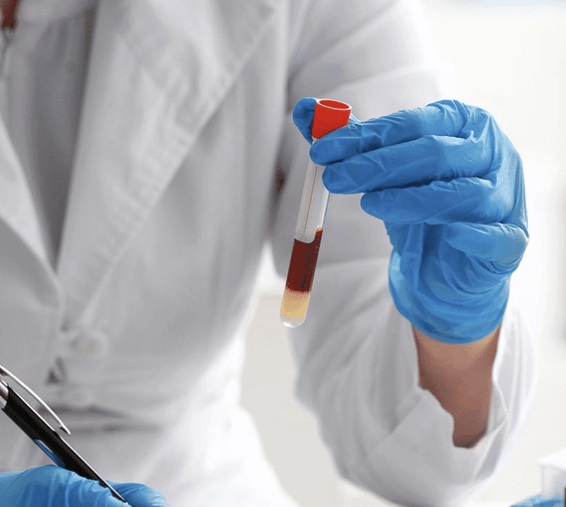 7 Powerful Reasons Blood Testing Works