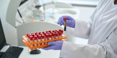 How One Blood Test Can Reveal A Lot About Men's Health: The Advanced Male Blood Test