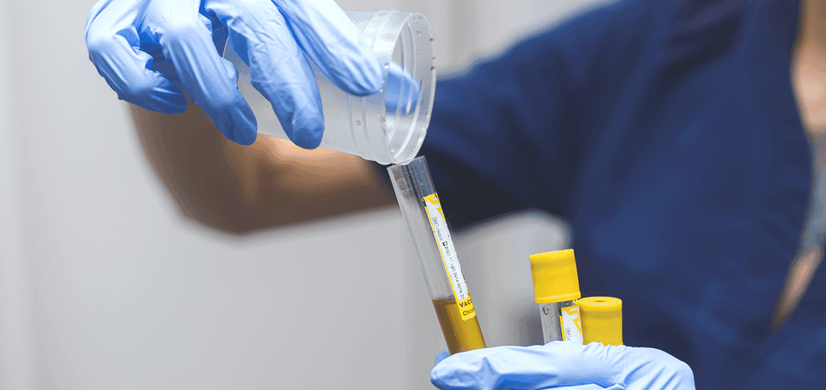 Comprehensive STD test