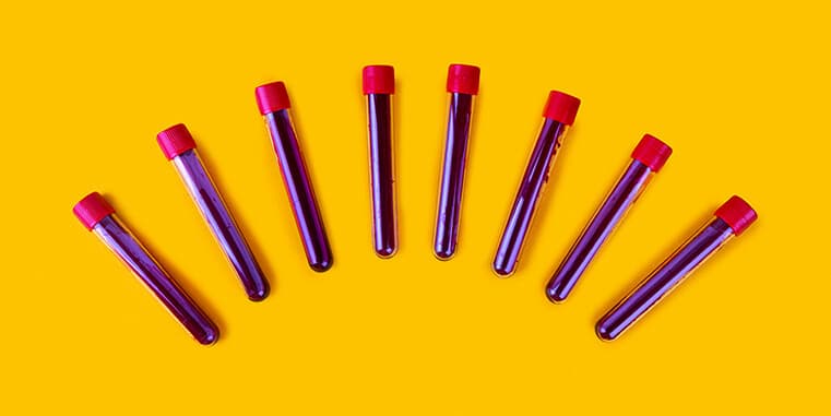 Blood biomarkers: The secret weapon for optimizing your fitness routine