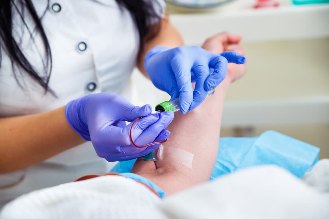 The Importance of Blood Testing & Why You Need It