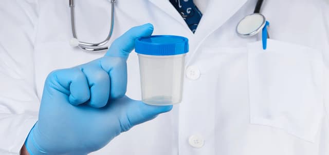 STD Test - 7 Panel