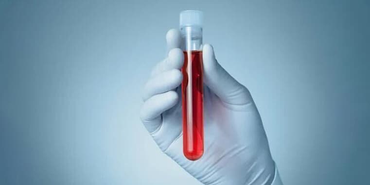 Blood Test at Home in Sharjah