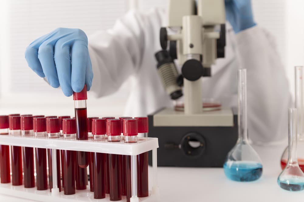 How to Prepare for Your CBC Blood Test in Dubai?